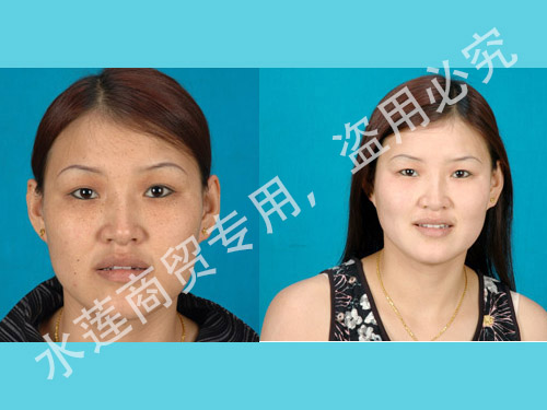 2016102860570205.jpg 2016102860570205.jpg