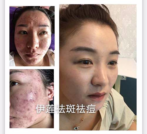 純中藥?kù)畎叽砑用苏猩? title=